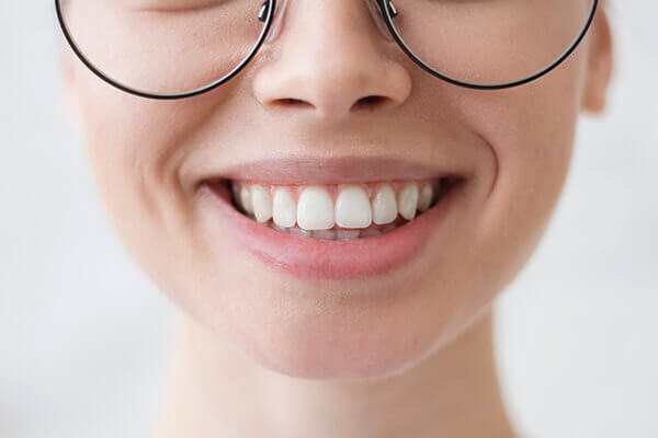 Ein schönes natürliches lächeln durch Ästhetische Zahnmedizin bei HarschDental