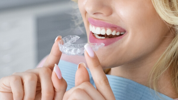 HarschDental Zahnarztpraxis setzt Aligner Schienen von Invisalign ein