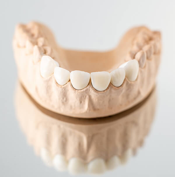 Zahnersatz wird bei HarschDental individuell geplant und präzise gefertigt