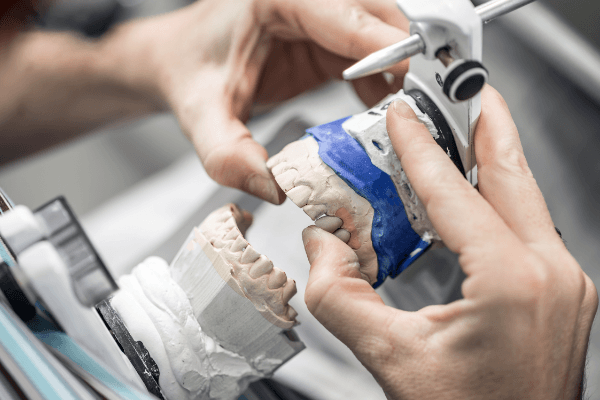 Zahnersatz wird bei HarschDental individuell geplant und präzise gefertigt