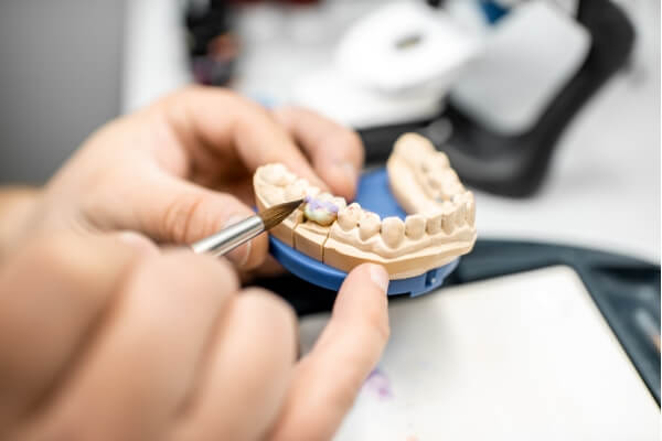 Zahnersatz mit Präzision Zahnersatz wird bei HarschDental mit höchster Präzision und Qualität hergestellt